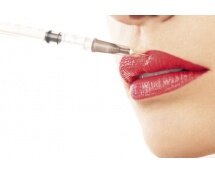 aufgespritzte Lippen - Top oder Flop?