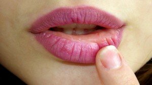 Da die Haut der Lippen sehr zart ist, muss diese besonders gepflegt werden